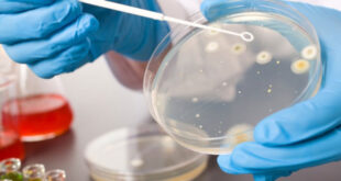 μικροβια-εργαστηριο